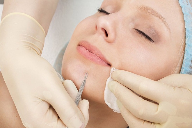 Механическая чистка лица: шаги и пункты процедуры у косметолога