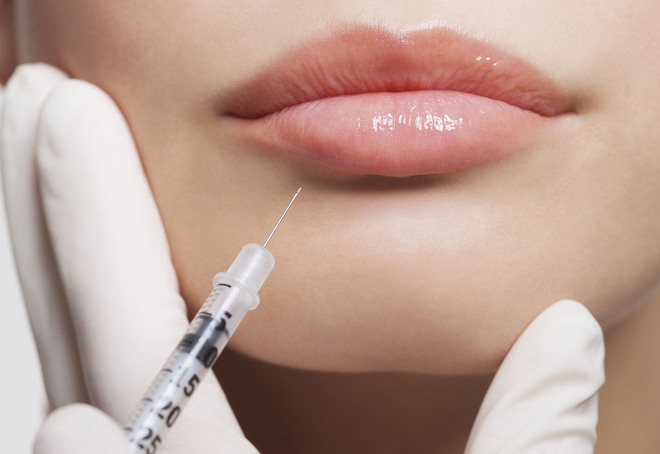 Коррекция губ гиалуроновой кислотой: безопасная и эффективная процедура